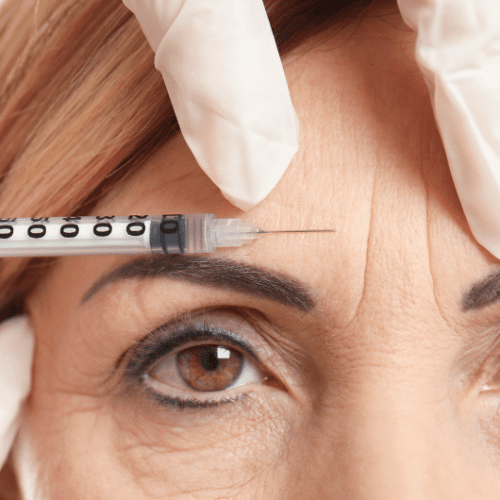 7 Things You Need to Know Before Getting Botox for Migraines
