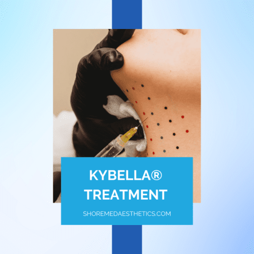 Kybella Treatment: The First & Only Injectable Double Chin Treatment