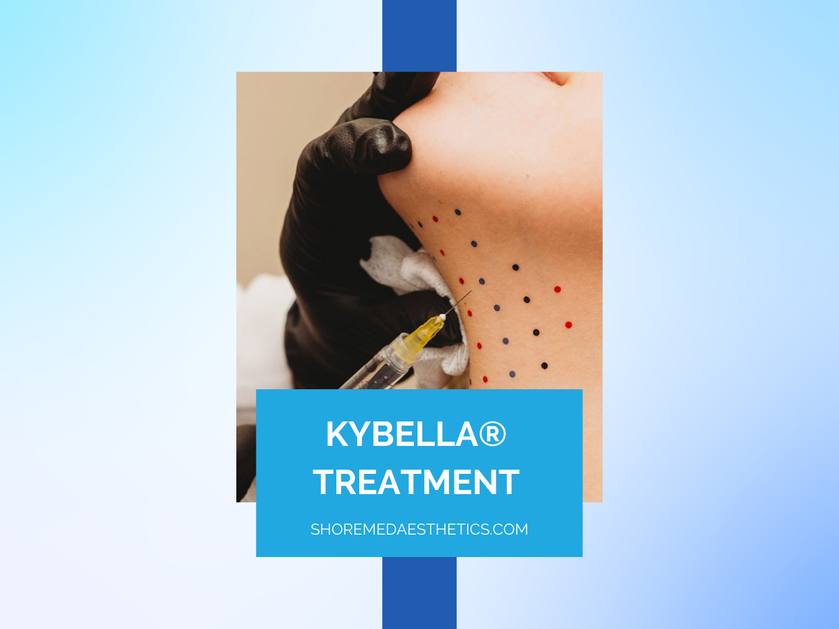 Kybella Treatment: The First & Only Injectable Double Chin Treatment