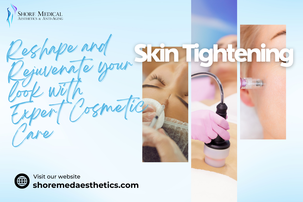 Top 3 Skin Tightening Treatments