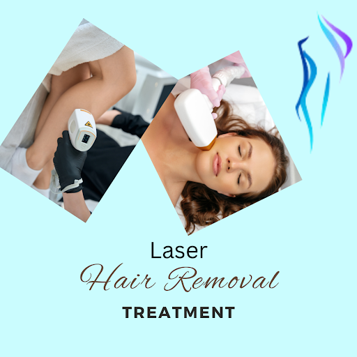 laser removal treatment
